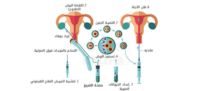 تلقیح المبيض